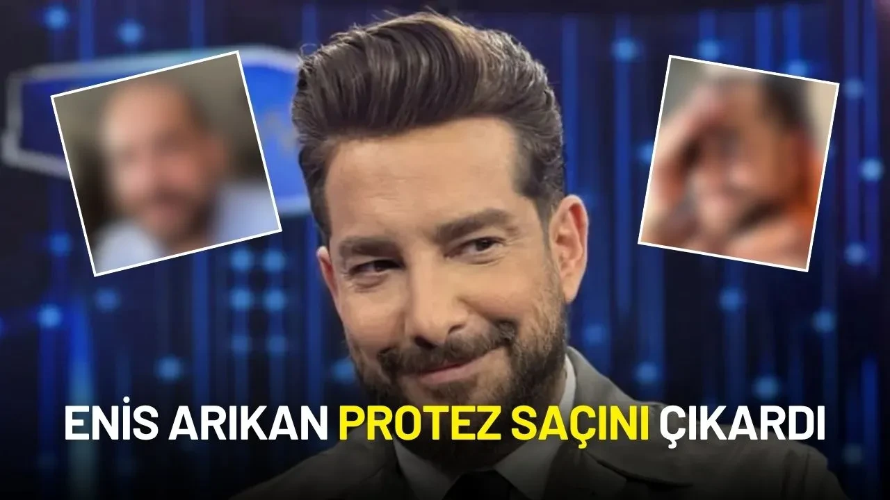 Enis Arıkan Protez Saçı Çıkardı, Yeni İmajıyla Sosyal Medyayı Salladı!