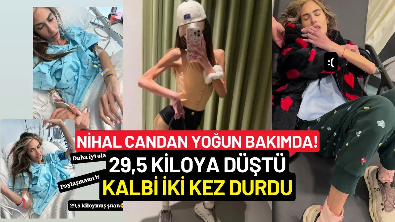 Nihal Candan Yoğun Bakımda: 29,5 Kiloya Düştü, Kalbi İki Kez Durdu