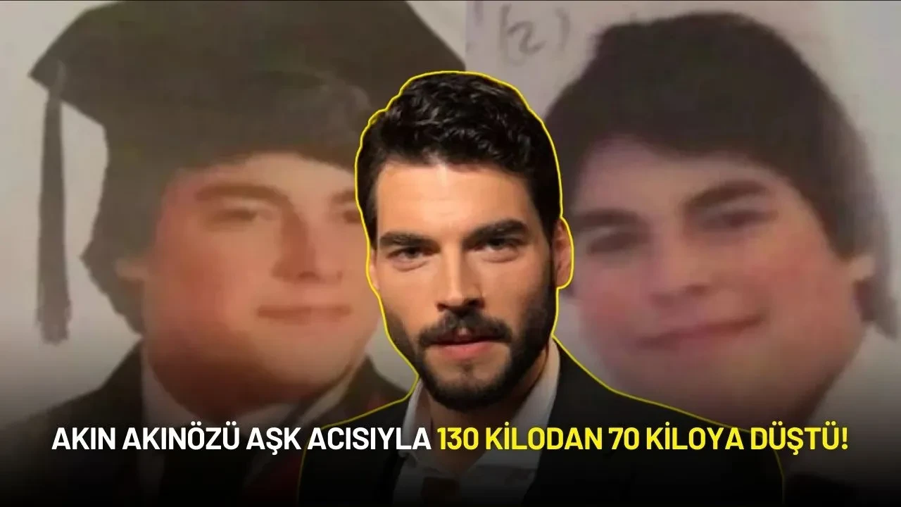 Akın Akınözü Aşk Acısıyla 130 Kilodan 70 Kiloya Düştü!