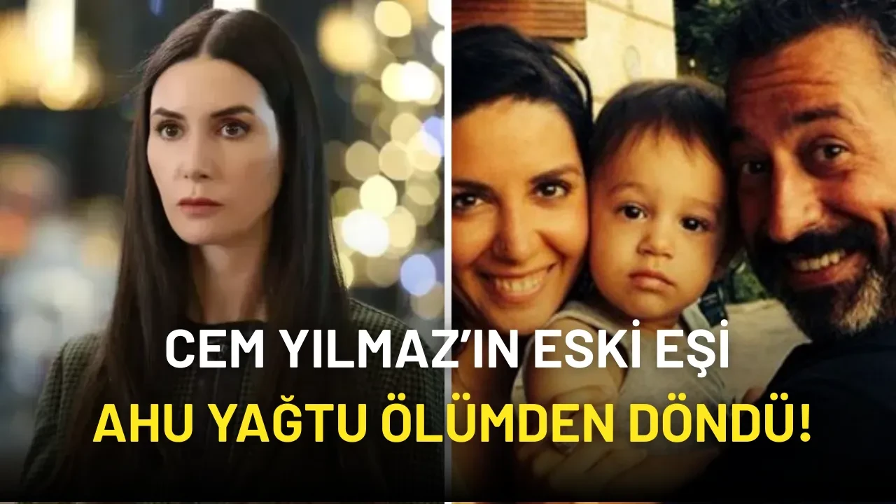 Cem Yılmaz’ın Eski Eşi Ahu Yağtu Ölümden Döndü! Beyin Damarlarından Biri Patlamak Üzereymiş