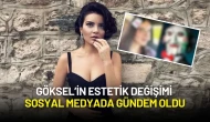 Göksel’in Estetik Değişimi Sosyal Medyada Gündem Oldu: Takipçileri 'Testere' Benzetmesi Yaptı