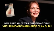 Danla Bilic Kalça Dolgusu Ameliyatı Oldu! Vücudundan Çıkan Madde Olay Oldu