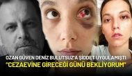 Ozan Güven’e Hapis Cezası! Deniz Bulutsuz: “Cezaevine Gireceği Günü Bekliyorum”