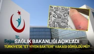 Sağlık Bakanlığı Açıkladı: Türkiye'de "Et Yiyen Bakteri" Vakası Görüldü mü?
