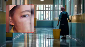 Şanlıurfa’da 7 Yaşındaki Öğrencinin Yüzünde Sigara Söndüren Temizlik Görevlisi Tutuklandı