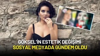 Göksel’in Estetik Değişimi Sosyal Medyada Gündem Oldu: Takipçileri 'Testere' Benzetmesi Yaptı