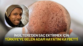 İngiltere'den Saç Ektirmek İçin Türkiye'ye Gelen Martyn James Latchman Hayatını Kaybetti