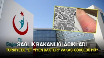 Sağlık Bakanlığı Açıkladı: Türkiye'de "Et Yiyen Bakteri" Vakası Görüldü mü?