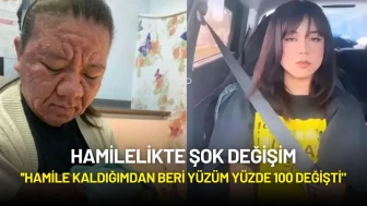 Hamilelikte Şok Değişim: ''Hamile Kaldığımdan Beri Yüzüm Yüzde 100 Değişti"