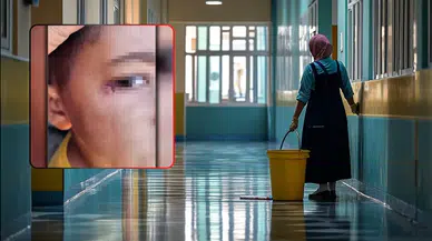 Şanlıurfa’da 7 Yaşındaki Öğrencinin Yüzünde Sigara Söndüren Temizlik Görevlisi Tutuklandı