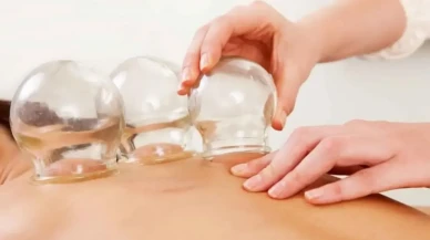Hacamat Nedir? 2025 Altın Hacamat Günleri ve Faydaları Nelerdir?