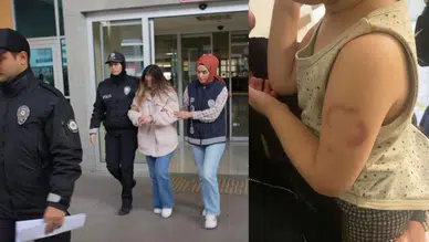 Edirne’de 3 Yaşındaki Çocuğu Isıran Öğretmen Tutuklandı!