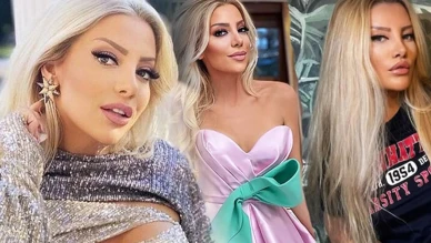 Gülşah Saraçoğlu’ndan Estetik Sonrası Görüntüsü Çok Konuşuldu!
