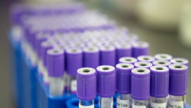 Kan Testi ile Erken Kanser Teşhisi Mümkün Mü? İngiltere’de Denemeler Başladı!