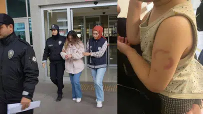 Edirne’de 3 Yaşındaki Çocuğu Isıran Öğretmen Tutuklandı!