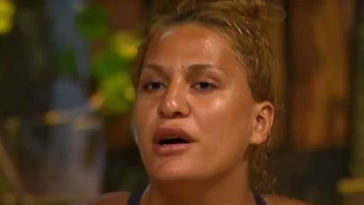 Survivor’dan Diskalifiye Edilen Almeda Baylan, Estetik Sonrası Şaşırttı