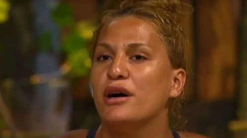 Survivor’dan Diskalifiye Edilen Almeda Baylan, Estetik Sonrası Şaşırttı
