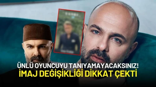 Erkan Avcı’dan Radikal İmaj Değişikliği: Sakallar Gitti, Protez Saç Geldi!