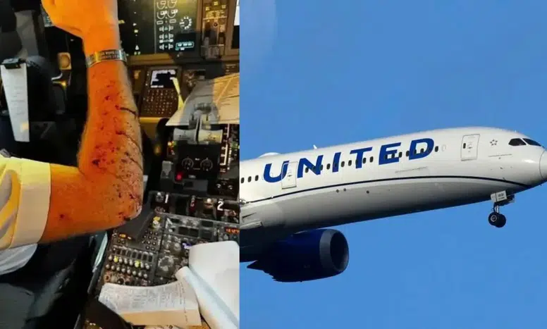 Uçağa Havada Meteor Çarptı: Pilot Yaralandı, Uçak Acil İniş Yaptı!